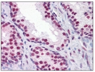 AM20583PU-N - RUNX2
