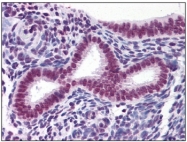 AM20583PU-N - RUNX2