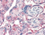 AP22651PU-N - Laminin