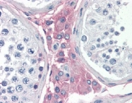 AP22651PU-N - Laminin