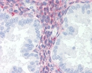 AM20492PU-N - CD91 / LRP1