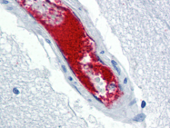 AP22470PU-N - von Willebrand factor (VWF)