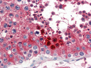AP22475PU-N - Apolipoprotein J / Apo J
