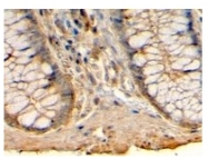 AP23217PU-N - Histamine H1 receptor