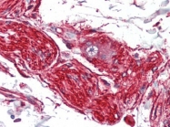 AM20515PU-N - S100A10