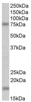 AP23236PU-N - Transglutaminase-7 (TGM7)