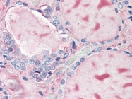 AM20511PU-N - Thyroglobulin