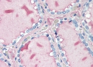 AM20510PU-N - Thyroglobulin