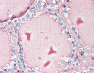 AM20509PU-N - Thyroglobulin