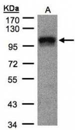 AP23160PU-N - eIF4G2 / DAP5