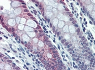 AP23017PU-N - HDAC2