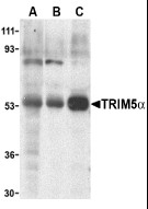 AP22936PU-N - TRIM5 / RNF88