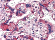 AP22934AF-N - Collagen type VI