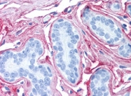 AP22819PU-N - Collagen type VI