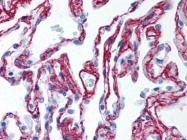 AP22819PU-N - Collagen type VI