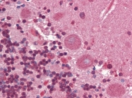 AP22813AF-N - Collagen type I