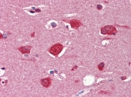AP22813AF-N - Collagen type I