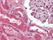 AP22813AF-N - Collagen type I