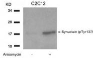 AP09477PU-S - Alpha-Synuclein / SNCA