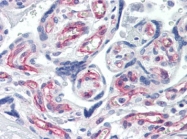 AP22785PU-N - Presenilin-1+2