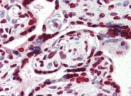AP22498PU-N - HMGA1 / HMGIY