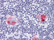 AM20575PU-N - CD1b