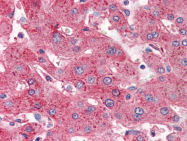 AP22484PU-N - Apolipoprotein C I / ApoC1
