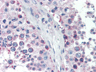 AP22485PU-N - GPSM2