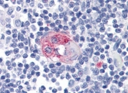 AM20565PU-N - CD23