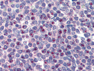 AP22489PU-N - FOXC1 / FKHL7 / FREAC3