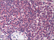 AP22495PU-N - HNF4 alpha / TCF14