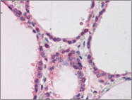 AP22495PU-N - HNF4 alpha / TCF14