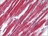 AP22503PU-N - CD295 / Leptin Receptor