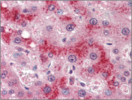 AP22503PU-N - CD295 / Leptin Receptor