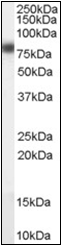 AP22505PU-N - CPT1A / CPT1-L