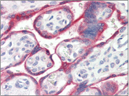 AP22508PU-N - Aromatase