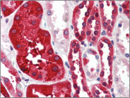 AP22513PU-N - Ferritin heavy chain (FTH1)