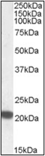 AP22513PU-N - Ferritin heavy chain (FTH1)