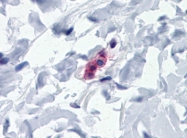 AM20559PU-N - FCER1A
