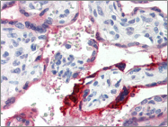 AP22515PU-N - Annexin A1 / ANXA1