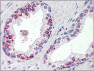 AP22515PU-N - Annexin A1 / ANXA1