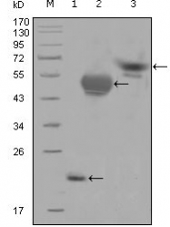 AM20557SU-N - Carbonic anhydrase 1