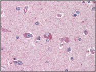 AP22516PU-N - PAFAH1B1 / LIS1