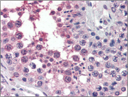AP22507PU-N - Activin receptor type 1 / ACRV1