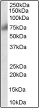 AP22518PU-N - FGFR1