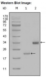 AM20554SU-N - Apolipoprotein(a) / LP(a)
