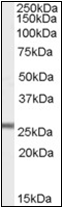 AP22523PU-N - Glutathione peroxidase 3 / GPX3