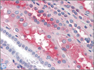 AP22524PU-N - Coagulation factor XII (F12)