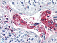 AP22524PU-N - Coagulation factor XII (F12)