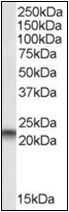 AP22528PU-N - PEBP1 / RKIP